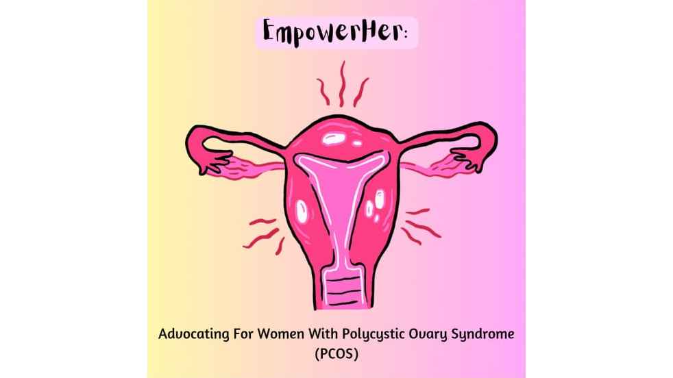 PCOS 