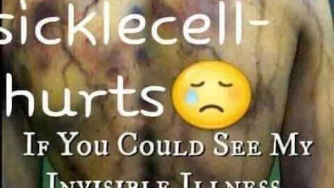 Image shows a pain induced body with the caption: If you could see my invisible illness, could you finally believe In in pain?